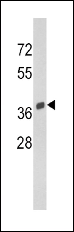 Invitrogen SPARC Polyclonal Antibody 400 &mu;L; Unconjugated:Antibodies,