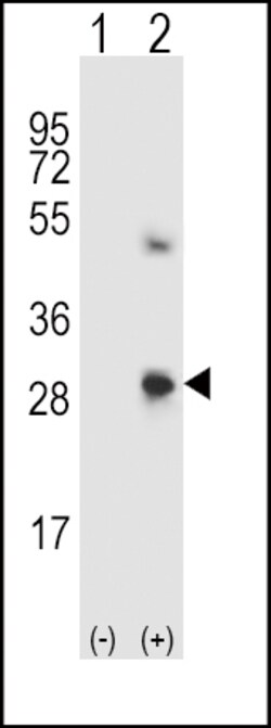 Invitrogen SPARC Polyclonal Antibody 400 &mu;L; Unconjugated:Antibodies,