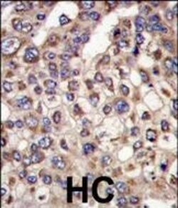 Invitrogen MTMR4 Polyclonal Antibody 400 &mu;L; Unconjugated:Antibodies,
