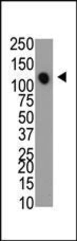 Invitrogen MTMR4 Polyclonal Antibody 400 &mu;L; Unconjugated:Antibodies,