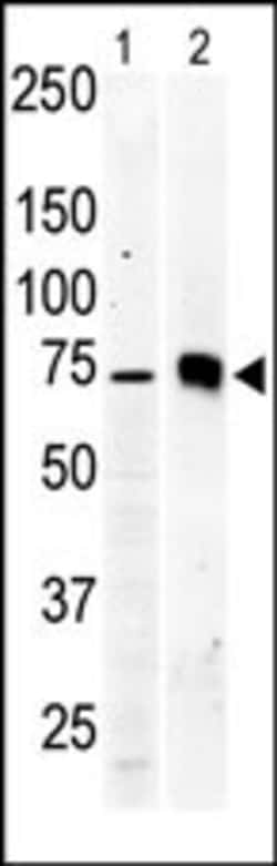 Invitrogen PKC beta-2 Polyclonal Antibody 400 &mu;L | Buy Online | Invitrogen&trade; | Fisher Scientific