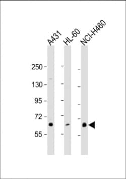 Invitrogen PKC eta Polyclonal Antibody 400 &mu;L; Unconjugated:Antibodies,