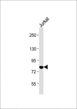 Invitrogen PKC theta Polyclonal Antibody 400 μL; Unconjugated:Antibodies,