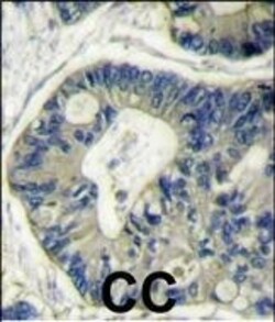 Invitrogen AKT2 Polyclonal Antibody 400 &mu;L; Unconjugated:Antibodies,