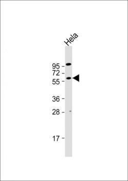 Invitrogen AKT2 Polyclonal Antibody 400 &mu;L; Unconjugated:Antibodies,