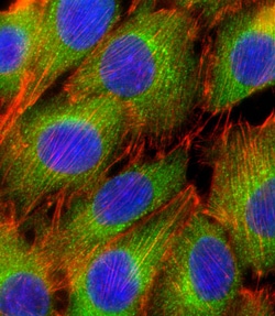 Invitrogen AKT2 Polyclonal Antibody 400 &mu;L; Unconjugated:Antibodies,