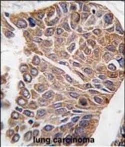 Invitrogen AKT2 Polyclonal Antibody 400 &mu;L; Unconjugated:Antibodies,