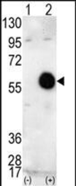 Invitrogen AKT2 Polyclonal Antibody 400 &mu;L; Unconjugated:Antibodies,