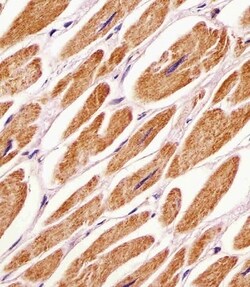 Invitrogen PDK4 Polyclonal Antibody 200 &mu;L; Unconjugated:Antistoffer