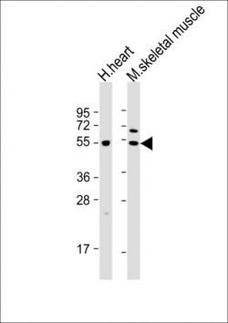 Invitrogen PDK4 Polyclonal Antibody 200 &mu;L; Unconjugated:Antistoffer