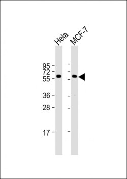 Invitrogen PKM2 Polyclonal Antibody 200 &mu;L | Buy Online | Invitrogen&trade; | Fisher Scientific
