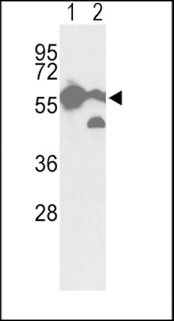 Invitrogen PKM2 Polyclonal Antibody 200 &mu;L | Buy Online | Invitrogen&trade; | Fisher Scientific