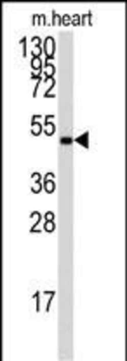 Invitrogen AMPK gamma-1 Polyclonal Antibody 400 &mu;L; Unconjugated:Antibodies,