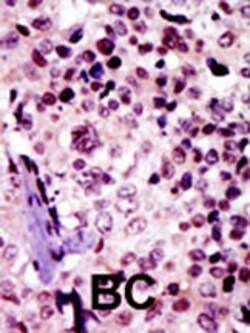 Invitrogen PRKAR1B Polyclonal Antibody 400 &mu;L; Unconjugated:Antibodies,
