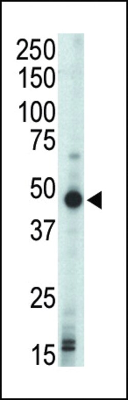Invitrogen PRKAR1B Polyclonal Antibody 400 &mu;L; Unconjugated:Antibodies,