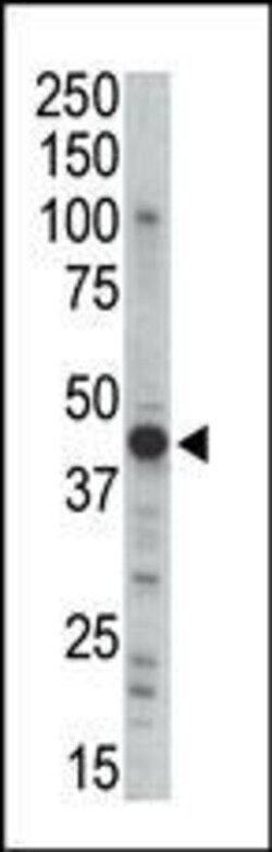 Invitrogen PRKAR2B Polyclonal Antibody 400 &mu;L; Unconjugated:Antibodies,
