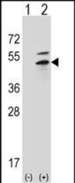 Invitrogen PRKAR2B Polyclonal Antibody 400 &mu;L; Unconjugated:Antibodies,