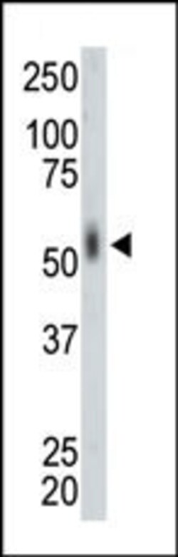 Invitrogen MKNK2 Polyclonal Antibody 400 &mu;L; Unconjugated:Antibodies,
