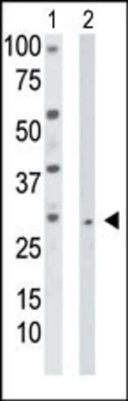 Invitrogen TK2 Polyclonal Antibody 400 &mu;L; Unconjugated:Antibodies,