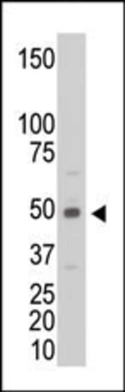 Invitrogen Creatine Kinase MB Polyclonal Antibody 400 μL; Unconjugated:Antibodies,