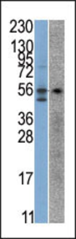Invitrogen STK38 Polyclonal Antibody 400 &mu;L; Unconjugated:Antibodies,