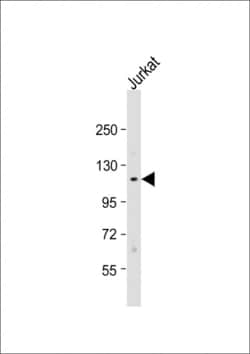 Invitrogen TAOK1 Polyclonal Antibody 400 &mu;L; Unconjugated:Antibodies,