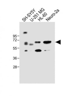 Invitrogen CERK Polyclonal Antibody 400 &mu;L; Unconjugated:Antibodies,