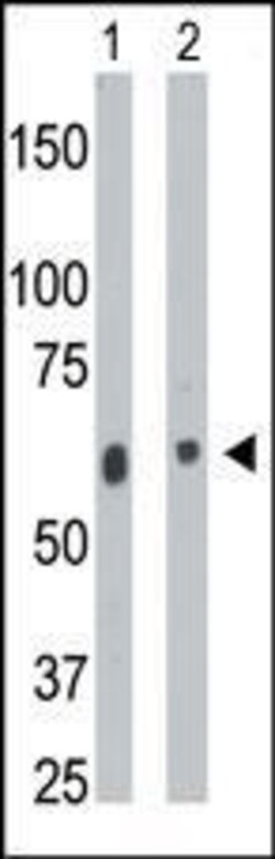 Invitrogen CERK Polyclonal Antibody 400 &mu;L; Unconjugated:Antibodies,