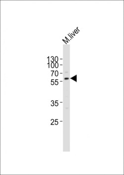 Invitrogen ACVR2A Polyclonal Antibody 400 &mu;L; Unconjugated:Antibodies,