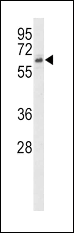 Invitrogen ACVR2B Polyclonal Antibody 400 &mu;L; Unconjugated:Antibodies,