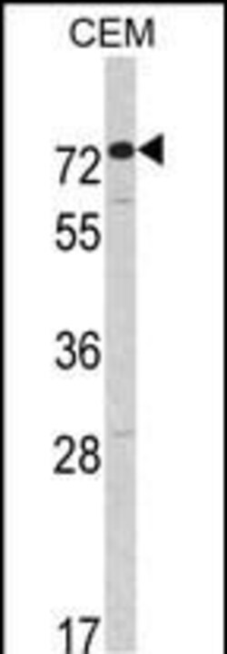 Invitrogen AMHR2 Polyclonal Antibody 400 &mu;L; Unconjugated:Antibodies,