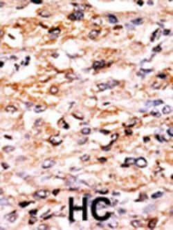Invitrogen GCN2 Polyclonal Antibody 400 &mu;L; Unconjugated:Antibodies,