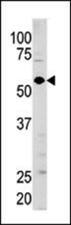 Invitrogen GUCY1A3 Polyclonal Antibody 400 μL; Unconjugated:Antibodies,