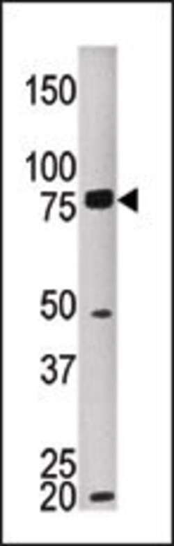 Invitrogen MELK Polyclonal Antibody 400 &mu;L; Unconjugated:Antibodies,