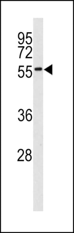 Invitrogen MKNK2 Polyclonal Antibody 400 &mu;L; Unconjugated:Anticuerpos