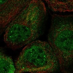 Invitrogen TTMP Polyclonal Antibody 100 &mu;L; Unconjugated:Antibodies,