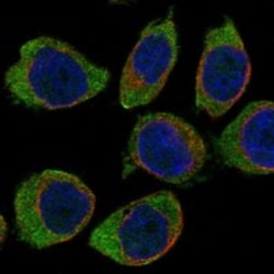 Invitrogen CD300a Polyclonal Antibody 100 &mu;L; Unconjugated:Antibodies,