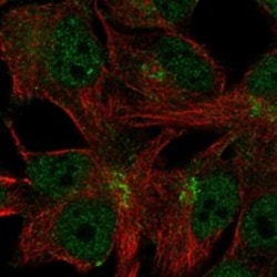 Invitrogen C11orf24 Polyclonal Antibody 100 &mu;L; Unconjugated:Antibodies,