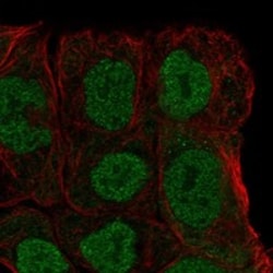 Invitrogen MGAT4B Polyclonal Antibody 100 &mu;L; Unconjugated:Antibodies,