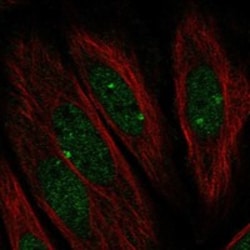 Invitrogen PARP3 Polyclonal Antibody 100 &mu;L; Unconjugated:Antibodies,