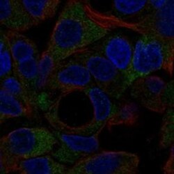 Invitrogen NOTUM Polyclonal Antibody 100 &mu;L; Unconjugated:Antibodies,