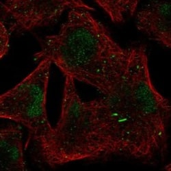 Invitrogen BTBD1 Polyclonal Antibody 100 &mu;L; Unconjugated:Antibodies,