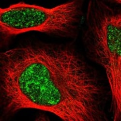 Invitrogen SIRT7 Polyclonal Antibody 100 &mu;L; Unconjugated:Antibodies,