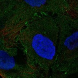 Invitrogen NMUR2 Polyclonal Antibody 100 &mu;L; Unconjugated:Antibodies,