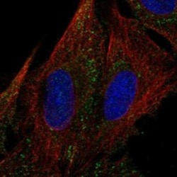 Invitrogen MYOM3 Polyclonal Antibody 100 &mu;L; Unconjugated:Antibodies,