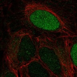 Invitrogen LEKR1 Polyclonal Antibody 100 &mu;L; Unconjugated:Antibodies,