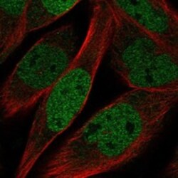 Invitrogen KLHL11 Polyclonal Antibody 100 &mu;L; Unconjugated:Antibodies,