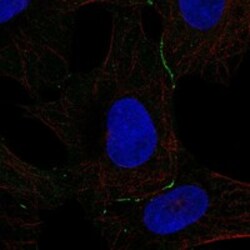 Invitrogen DPPA5 Polyclonal Antibody 100 &mu;L; Unconjugated:Antibodies,
