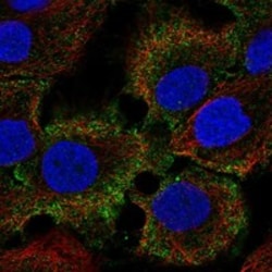 Invitrogen XP32 Polyclonal Antibody 100 &mu;L; Unconjugated:Antibodies,
