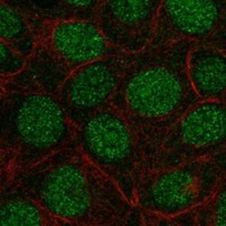 Invitrogen FAM90A1 Polyclonal Antibody 100 &mu;L; Unconjugated:Antibodies,